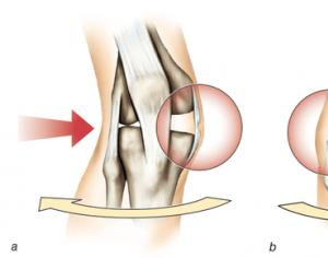 Ушиб колена: симптоматика травмы, правила оказания первой помощи и терапия Что делать если повредил колено