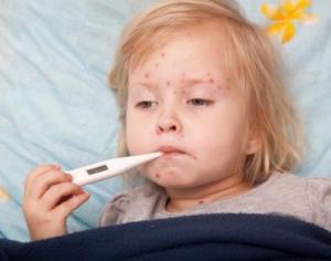 麻疹と水痘の見分け方
