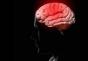 Što i zašto nastaju moždani udari?